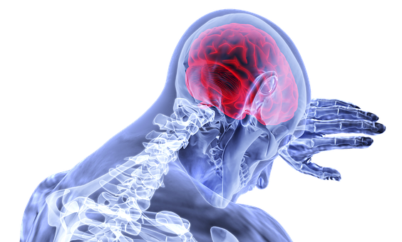 Jakie są objawy udaru mózgu?